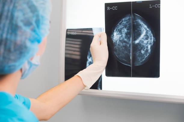 surgical oncology specialist